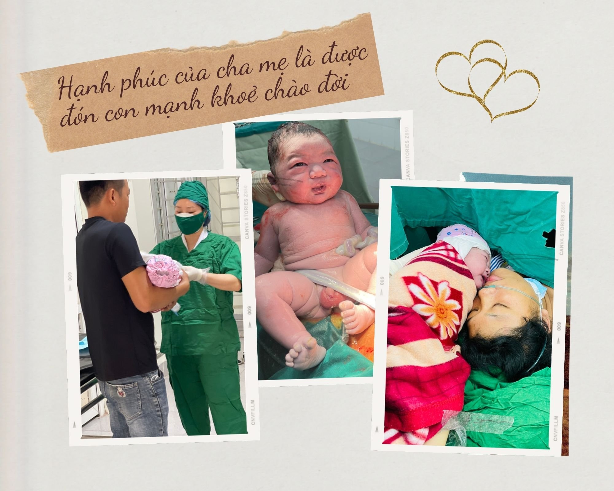 Trung tâm Y tế huyện Yên Thế phẫu thuật thành công thai nhi nặng 5kg